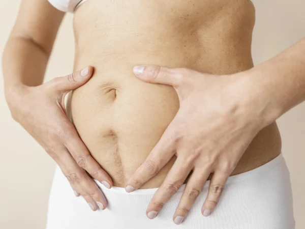 The Honest Timeline for ‘Scar Tape’ After a C-Section (What Actually Works)