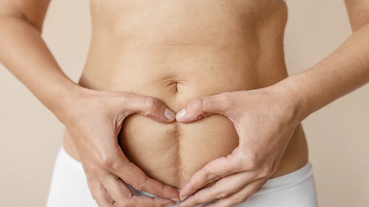 C‑Section Scar Healing: What’s Normal, Warning Signs, and Self‑Care Tips for New Moms