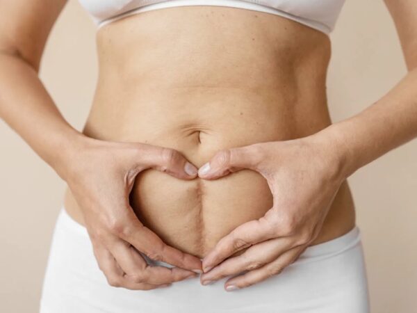 C‑Section Scar Healing: What’s Normal, Warning Signs, and Self‑Care Tips for New Moms